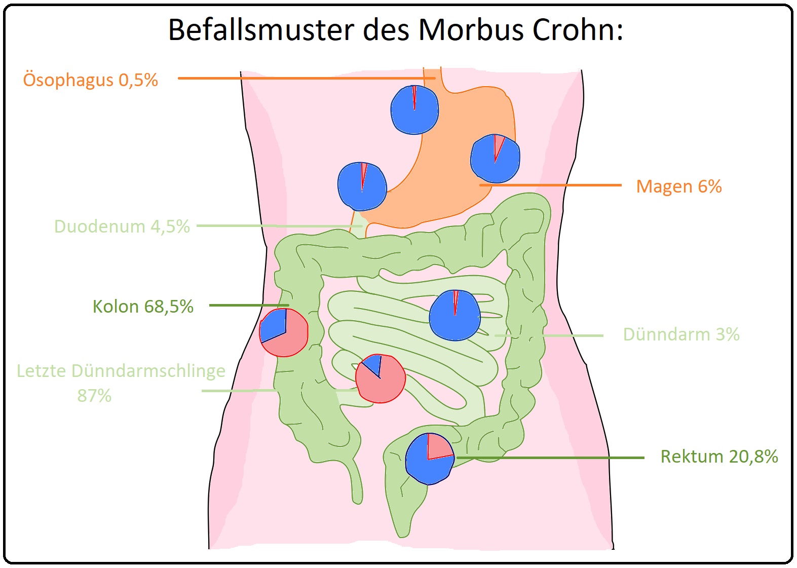 580 Befallsmuster des Morbus Crohn