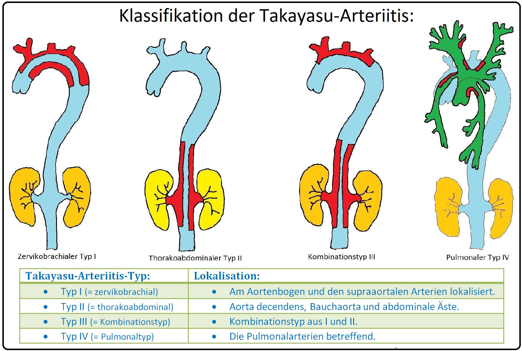 616 Klassifikation der Takayasu Arteriitis