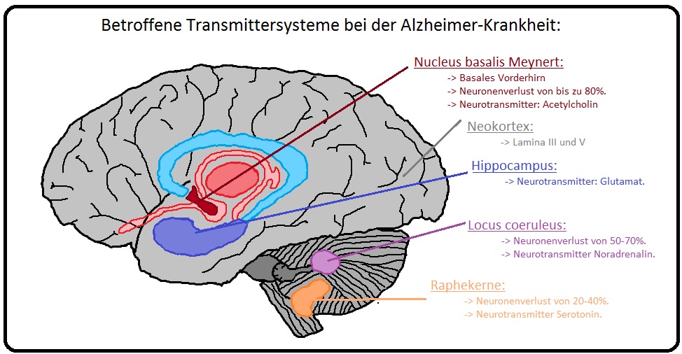 207 Betroffene Transmittersysteme bei der Alzheimer Krankheit