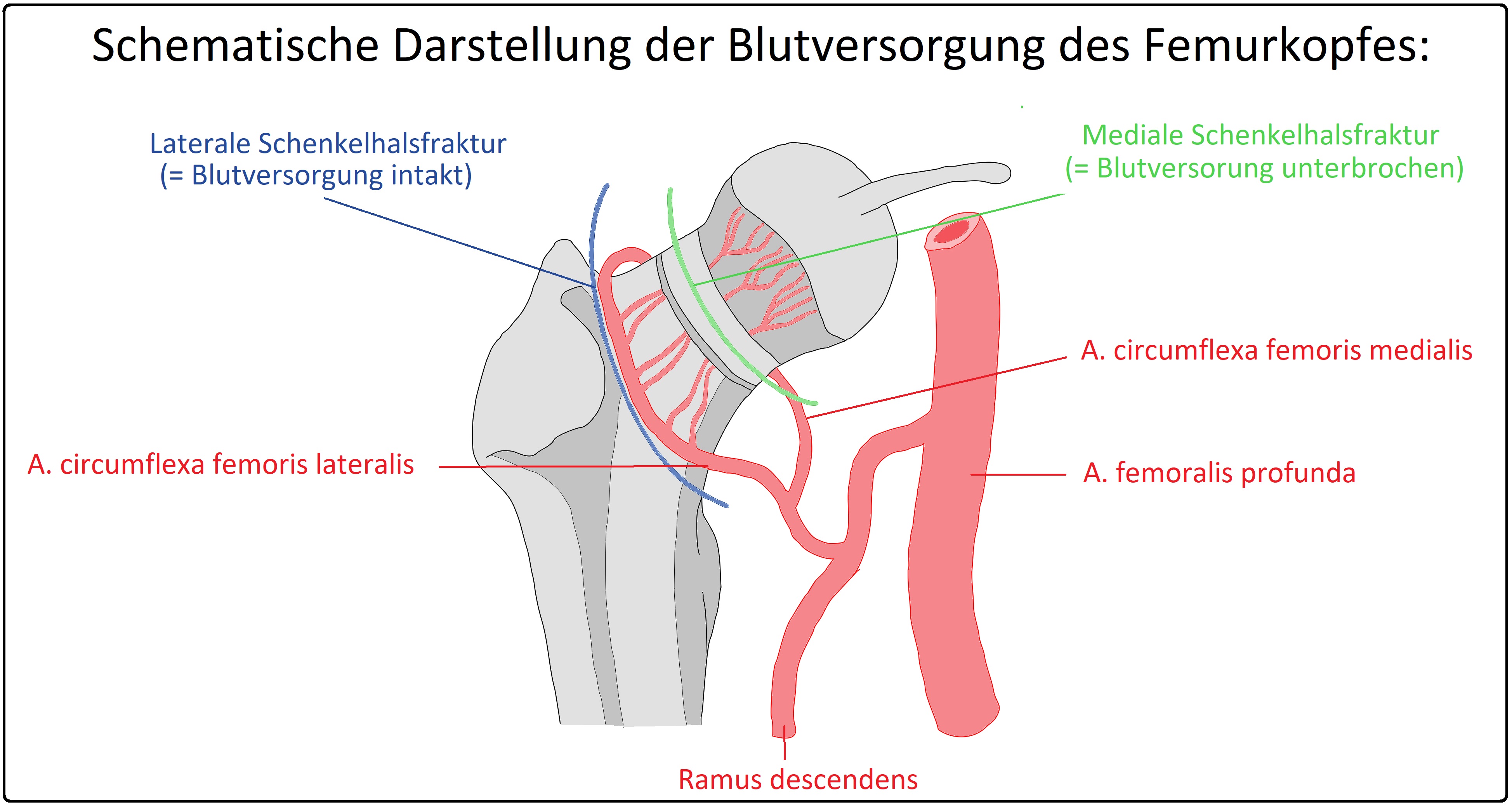 Schematische Darstellung der Blutversorgung des Femurkopfes